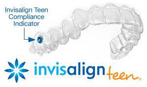 Todd Ray DMD: Invisalign Teen